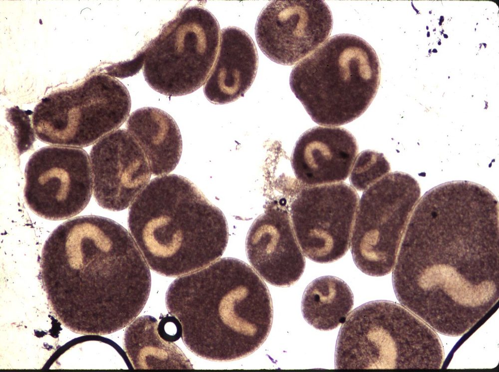 Ich parasites under a microscope, each showing a horseshoe-shaped nucleus